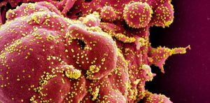 El coronavirus puede permanecer más de seis meses en la mucosa olfativa