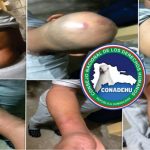 Conadehu denuncia patrulla Policía Nacional ocasiona golpes y heridas a dos ciudadanos